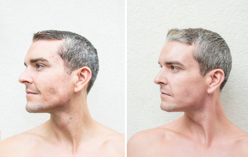 Gray's Skin Transformation